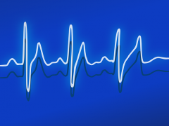 Bild zeigt eine Welle die wie ein Pulsmesser aussieht
